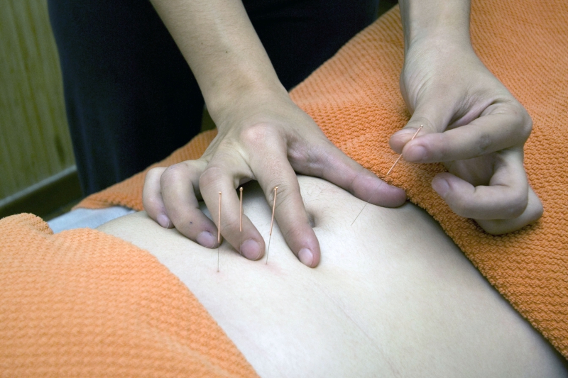 osteopathe-LE PRADET-min_acupuncture-4175625